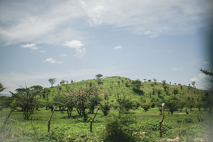 Premier Dentist San Francisco Dental Trip 08