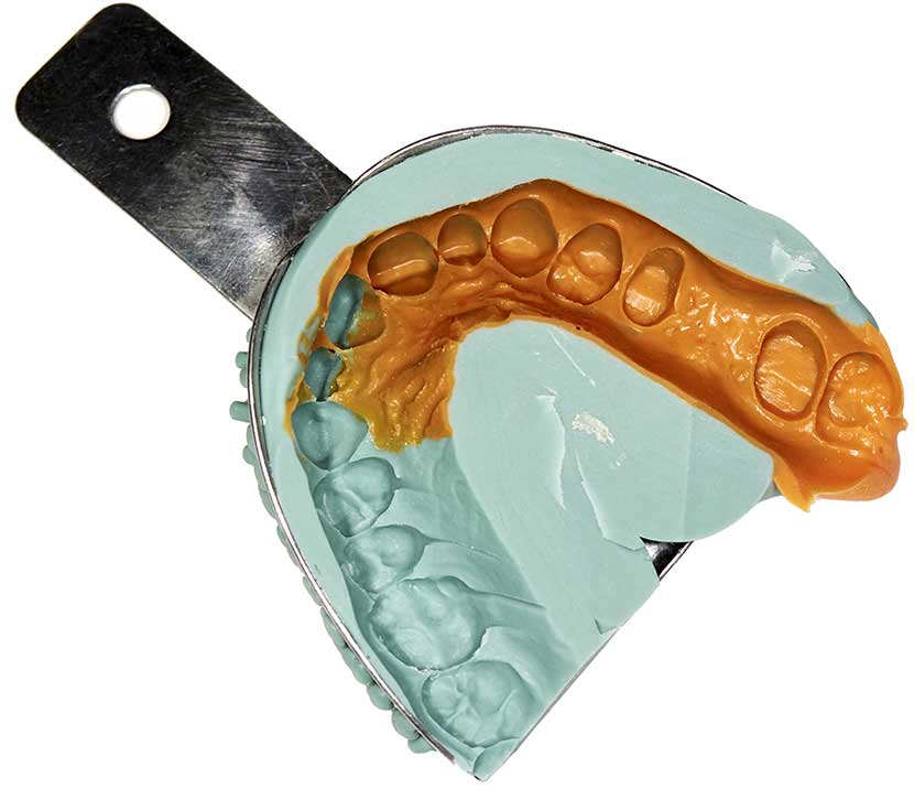 Dentures and Partial Dentures San Francisco Image